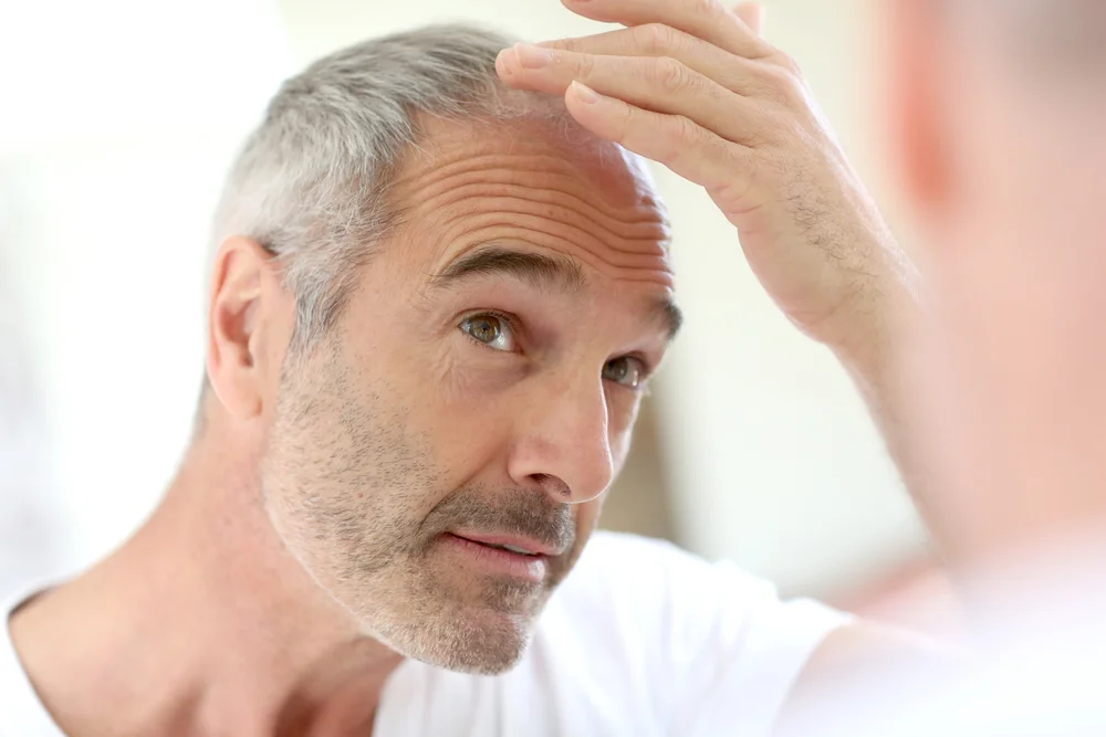 Close-up of a middle-aged man examining his hairline, representing hair thinning solutions via PRP hair restoration therapy.